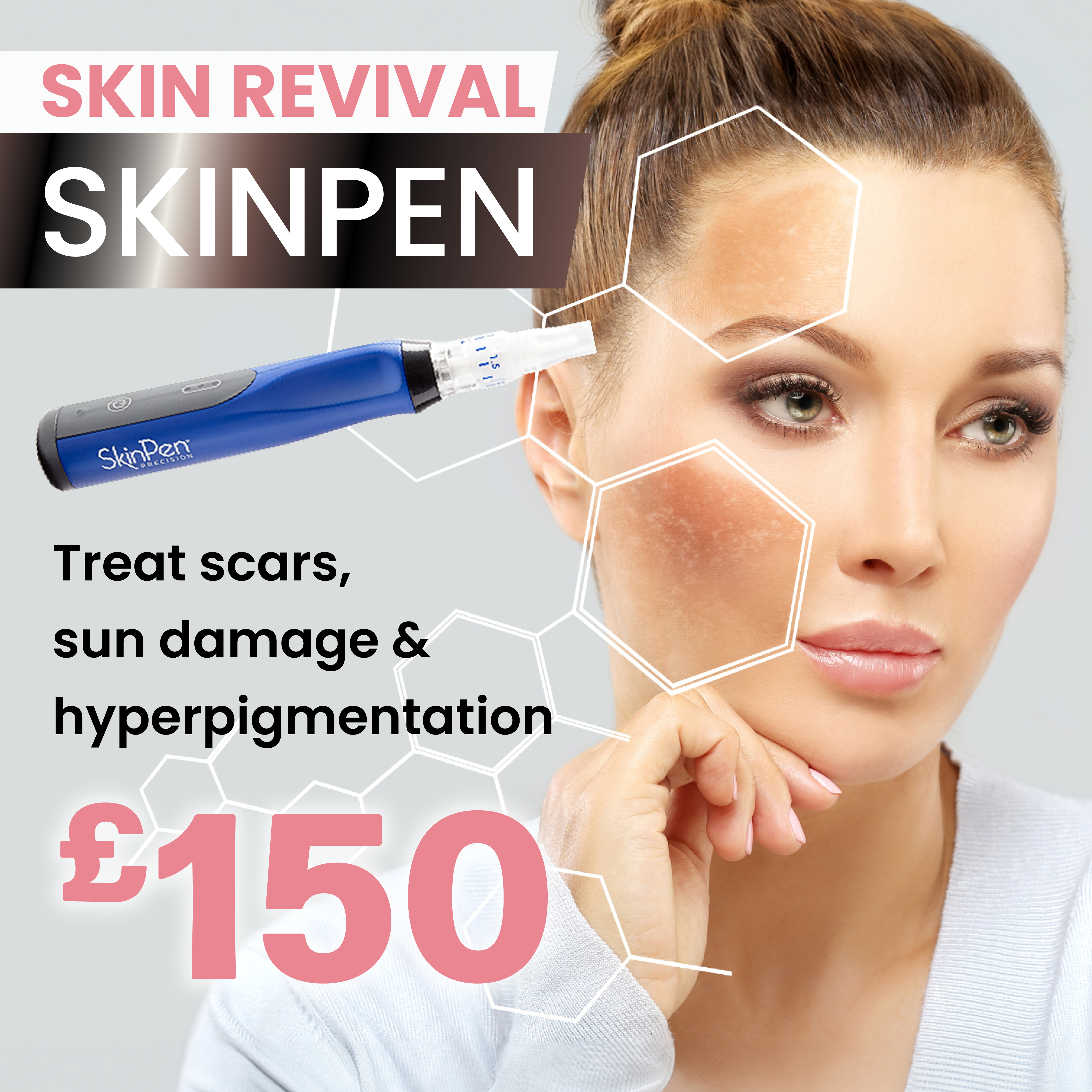 Skinpen £150